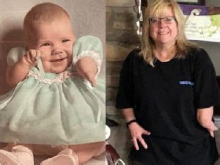Are any thalidomide babies still alive?