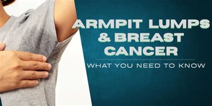 Are armpit lumps painful?