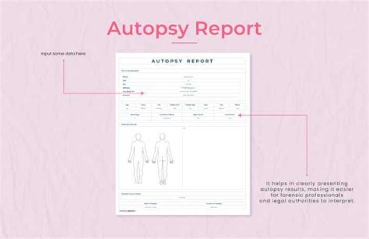 Are autopsy results public?
