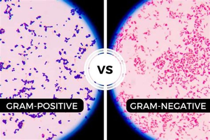 Are bacillus gram positive or negative?