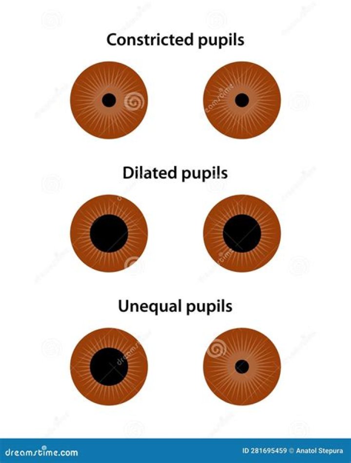 Are constricted pupils a sign of pain?