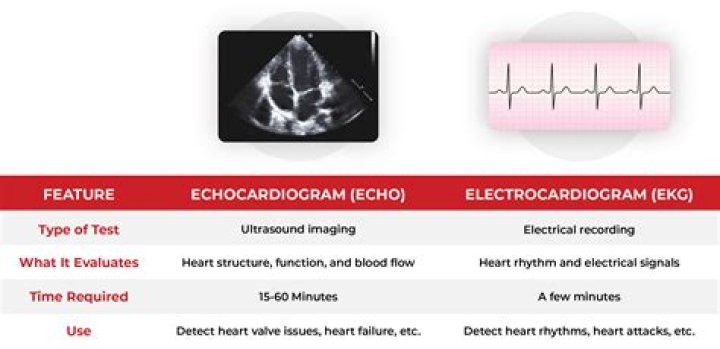 Are electrocardiogram and echocardiogram the same?