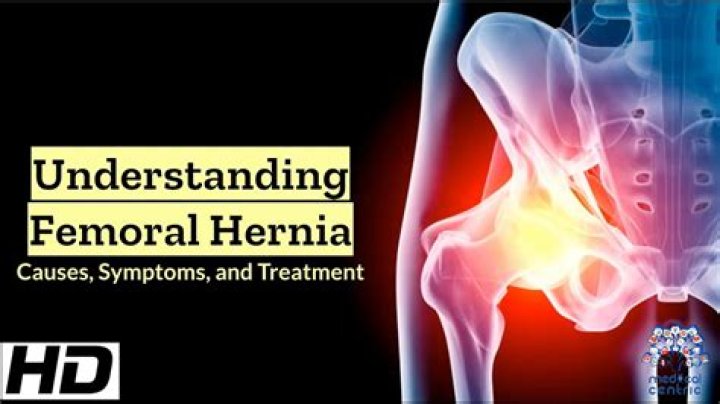 Are femoral hernias dangerous?