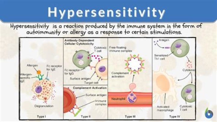 Are hypersensitivity disorders of the immune system?