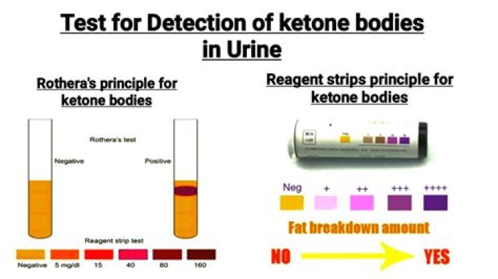 Are ketones in urine normal?