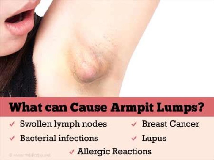 Are lumps under armpits normal?