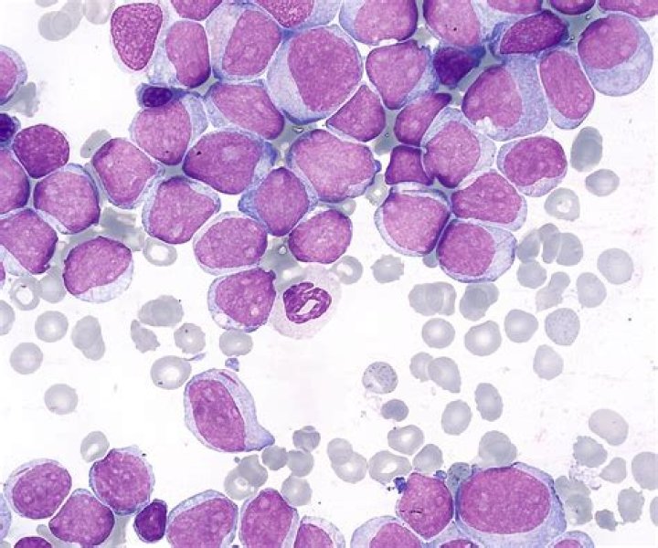 Are myeloid cells normal?