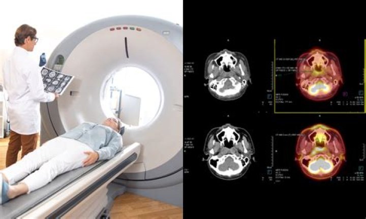 Are repeated ct scans dangerous?