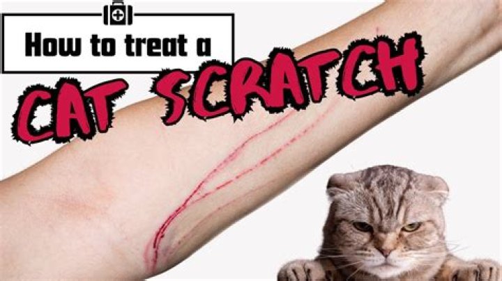 Are scratches from cats dangerous?