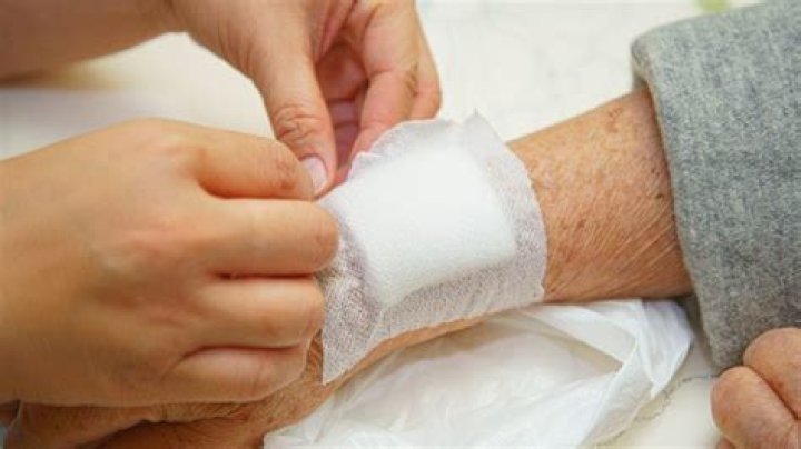 Are skin grafts painful?