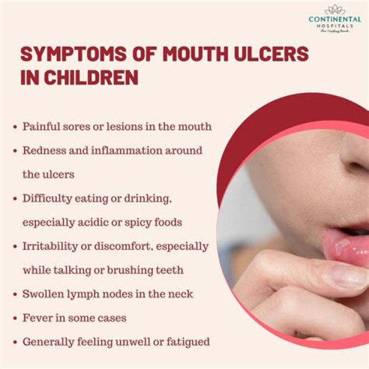 Are sores in the mouth a sign of covid?
