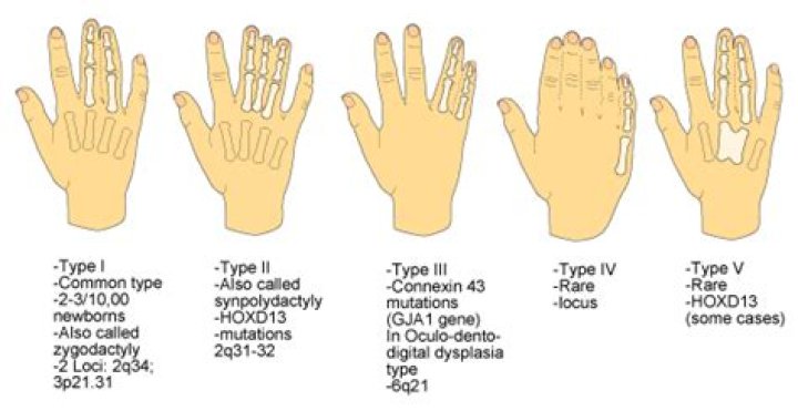 Are stubby thumbs genetic?