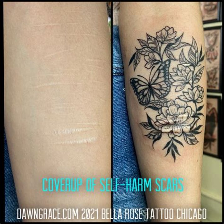 Are tattoos a scar?