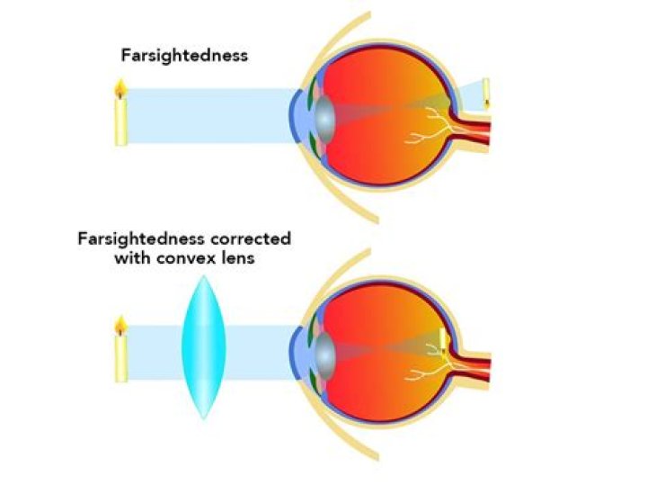 Are there contacts for farsighted?