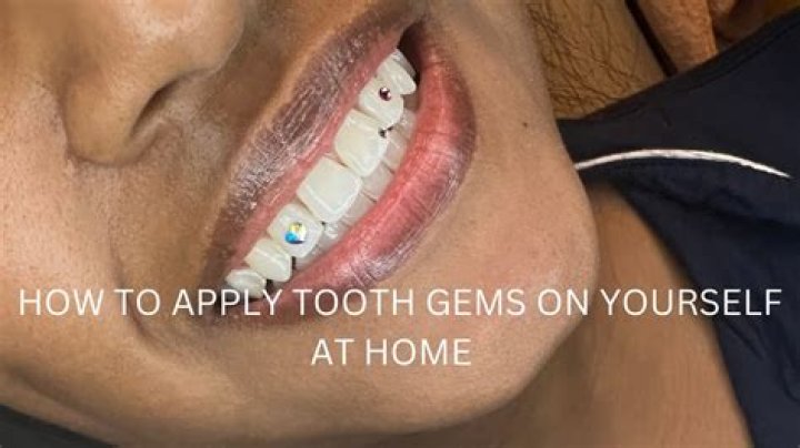 Are tooth gems appropriative?