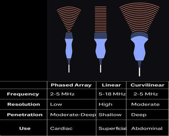 Are transducers passive components?