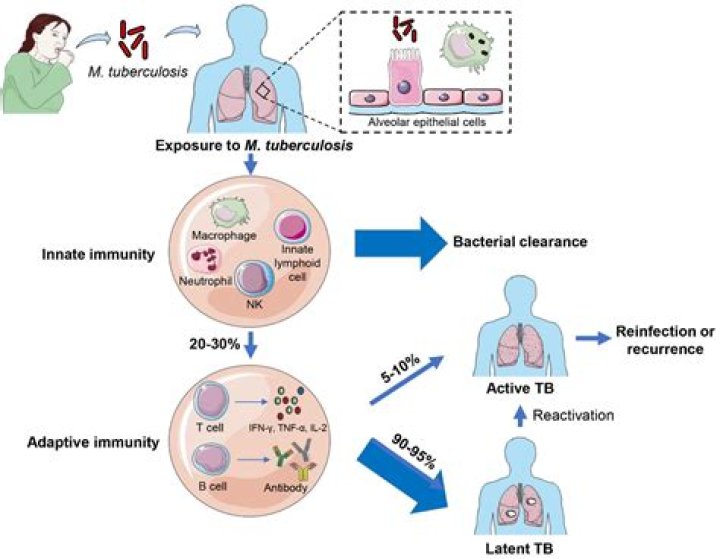 Are we immunized for tb?