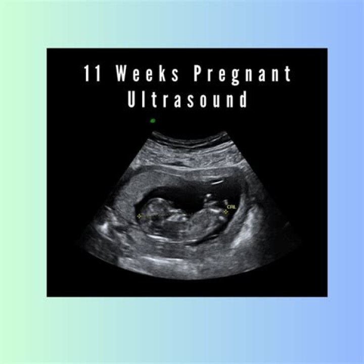 At 11 weeks what are the chances of miscarriage?