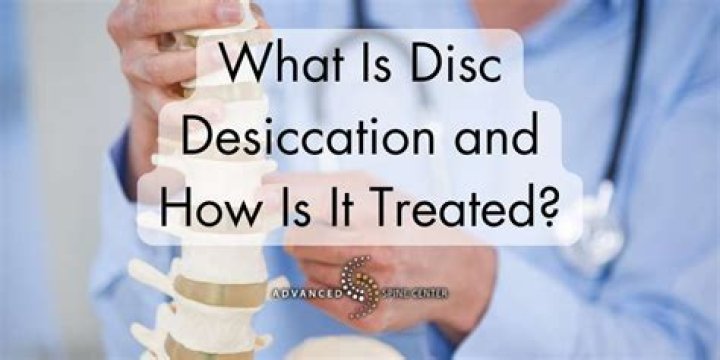 At what age does disc desiccation start?