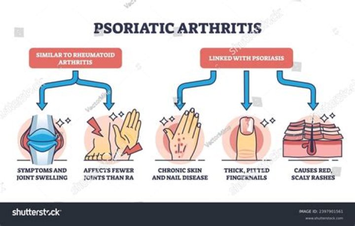 At what age does psoriatic arthritis start?