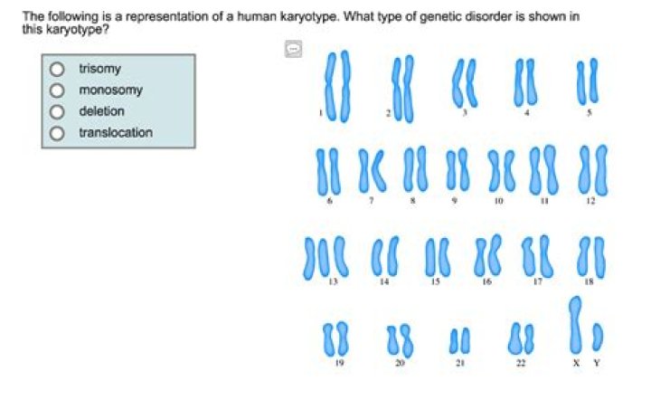 By analyzing the karyotype what chromosomal disorder is present?