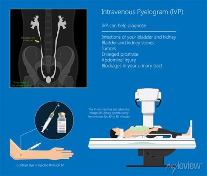 Can a intravenous pyelogram detect cancer?
