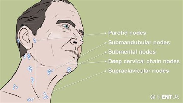 Can a strained neck cause swollen lymph nodes?