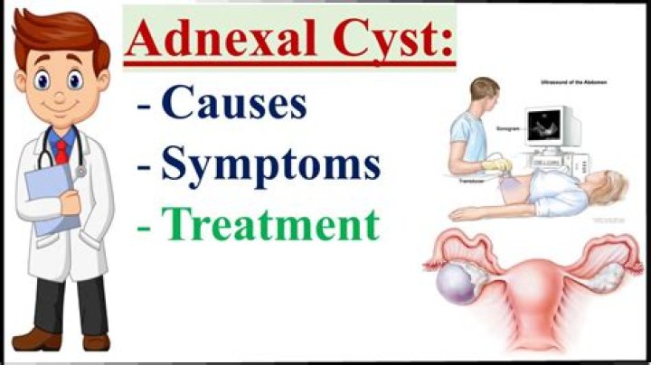 Can adnexal cyst be cancerous?