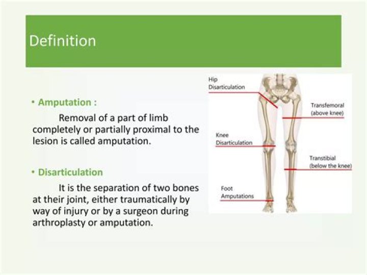 Can amputation be avoided?