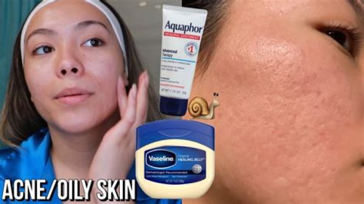 Can aquaphor be used on face?