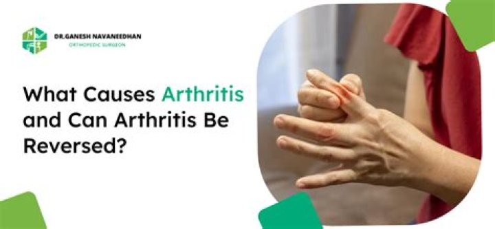 Can arthritis be reversed?
