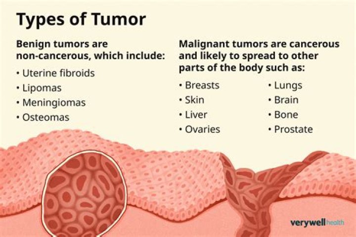Can benign tumors become cancerous?