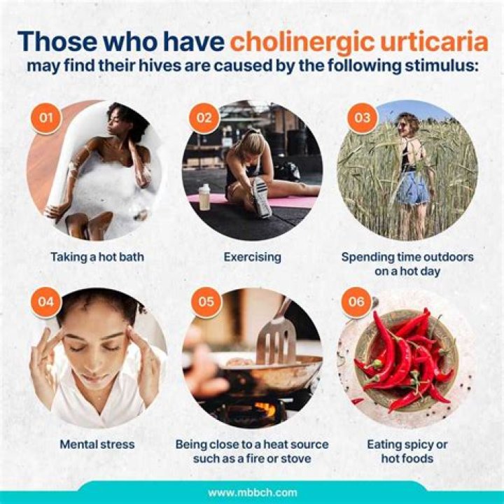 Can cholinergic urticaria be cured?