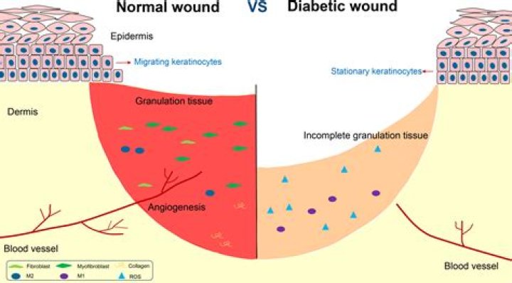Can dawn phenomenon occurs in non diabetics?