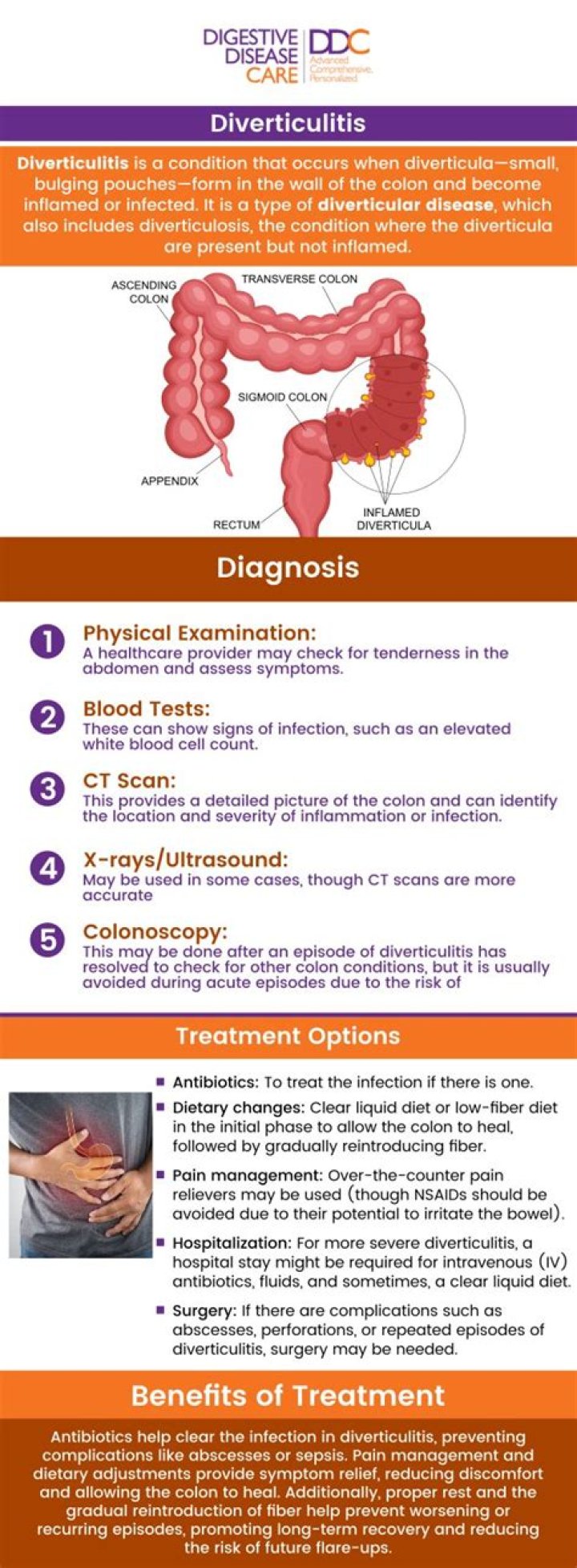 Can diverticulitis pain last for weeks?