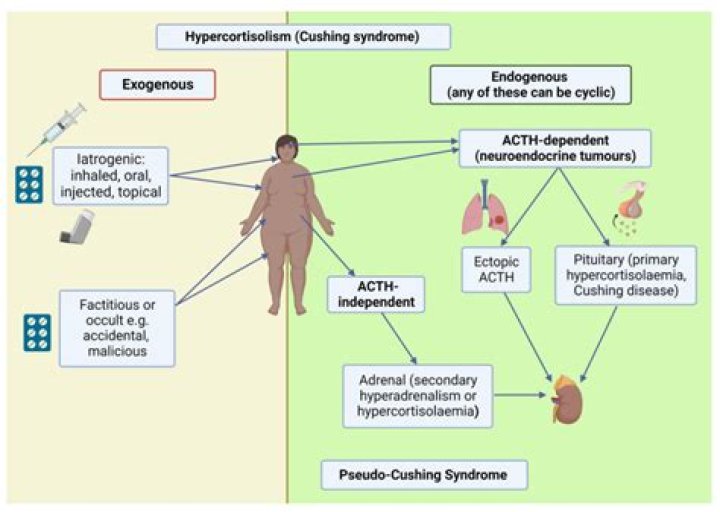 Can dumping syndrome cause diabetes?