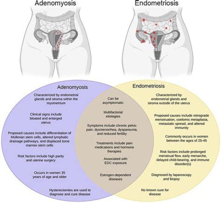 Can endometriosis cause complication?