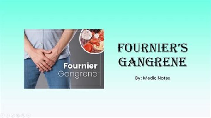 Can fournier's gangrene be cured?