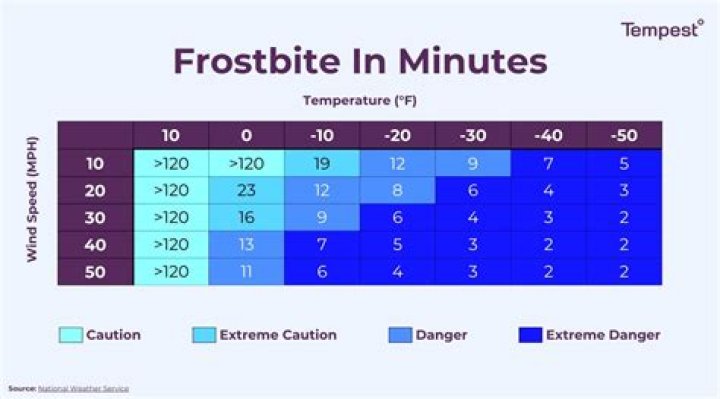 Can frostbite kill me?