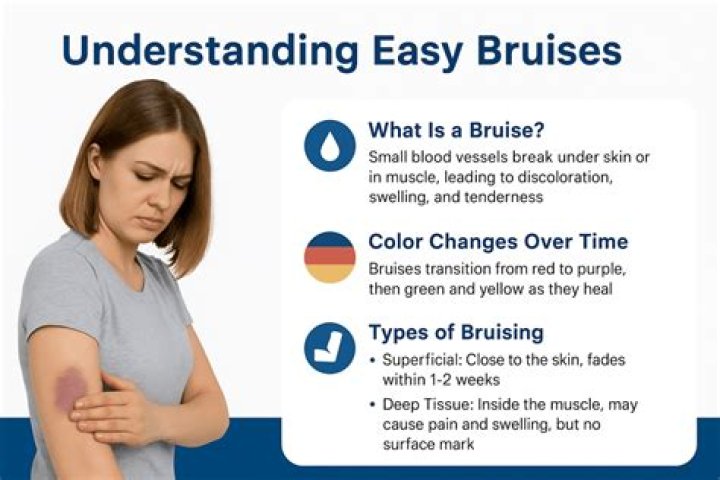 Can grabbing cause a bruise?