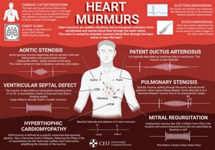Can heart murmurs come back?