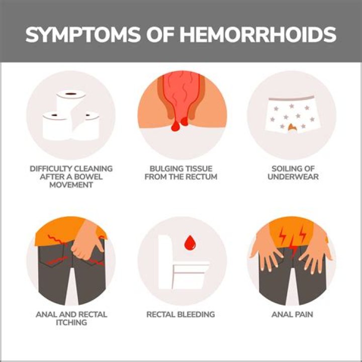 Can hemorrhoids kill you?