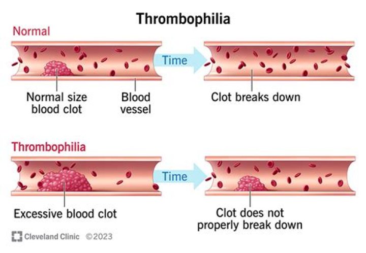 Can heparin cause blood clots?