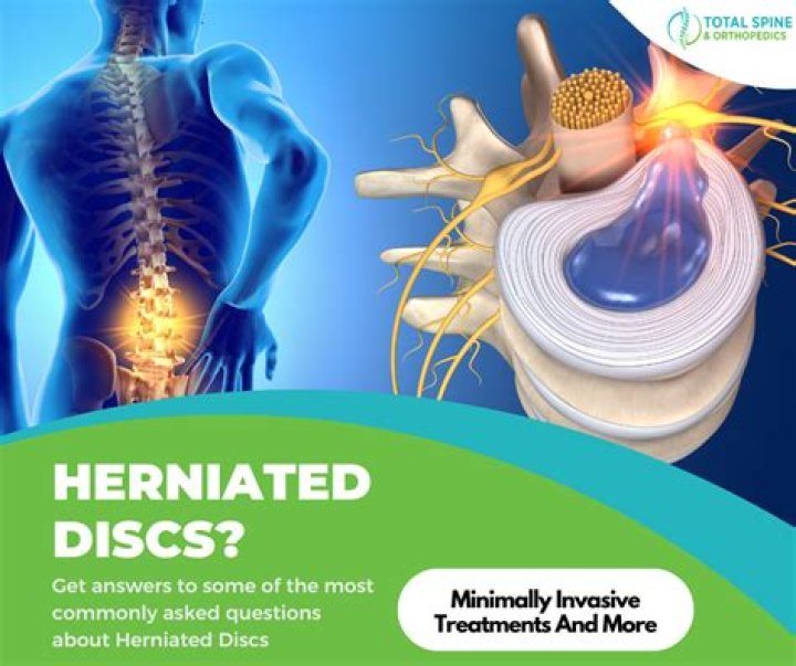 Can herniated discs cause shoulder pain?