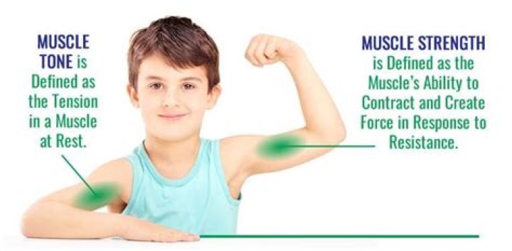 Can high muscle tone go away?