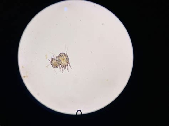 Can humans get ear mites from cats?