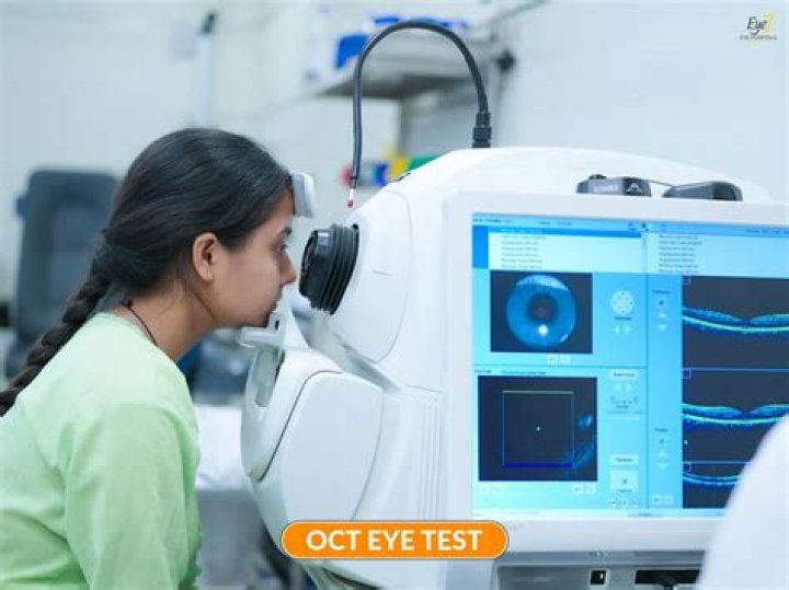 Can i drive after an oct test?