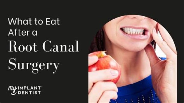 Can i eat after a root canal?