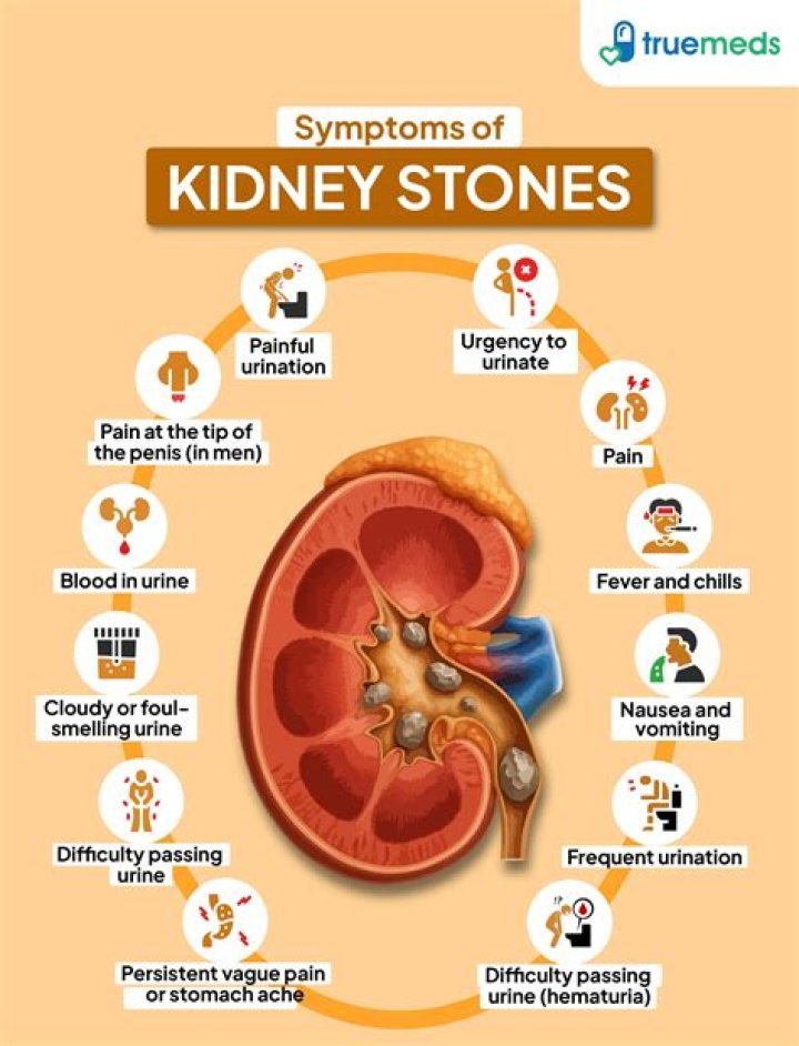 Can kidney stone cause bowel?