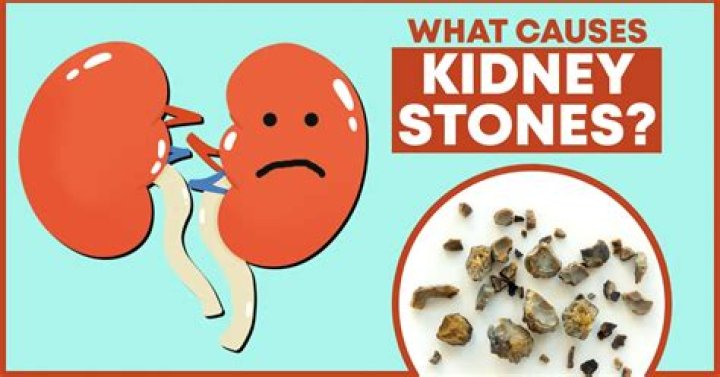 Can kidney stone kill you?